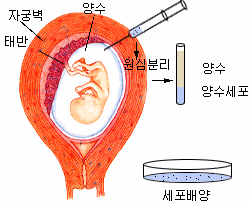 양수검사.gif